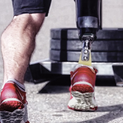 Ortho Active Feet Appliances