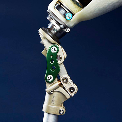 Ortho Active Joints Appliances