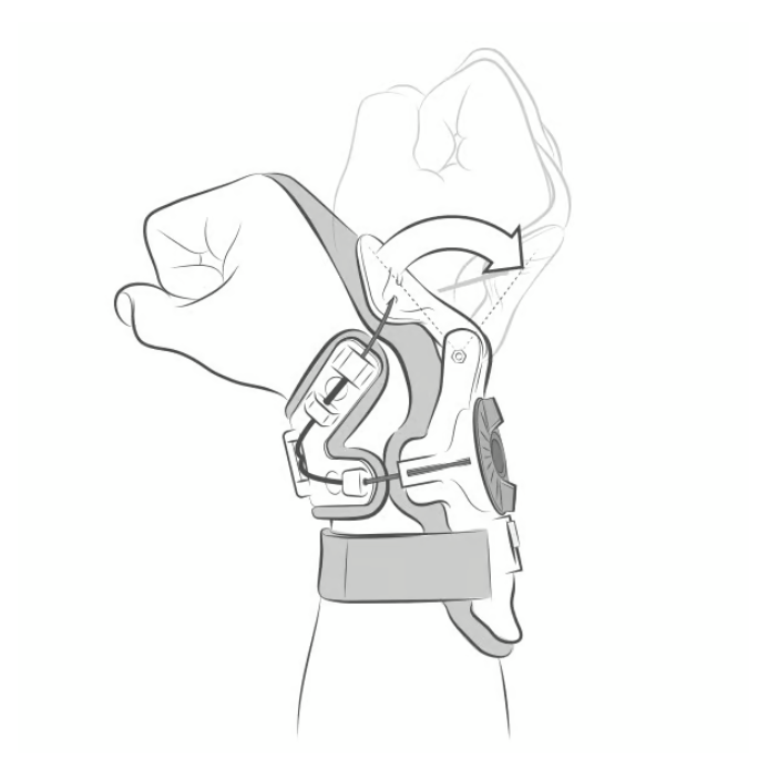 Mobius X8 Wrist Brace